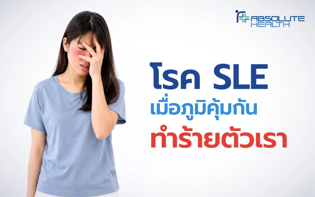 Banner โรค SLE AH 02 0 result